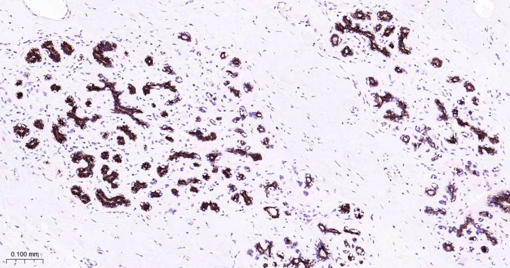 Human Keratin 7 Ready-To-Use IHC Kit (免疫组化试剂盒) - IHC-P | Bioss